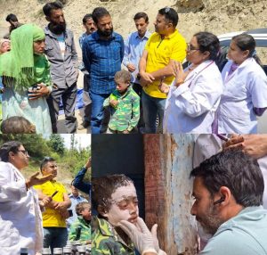Doda: Medical team visits village Thanalla to address Skin Disease among children
