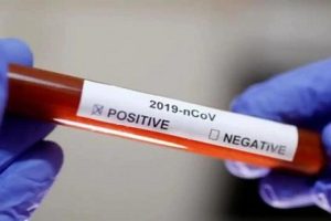 Seven COVID-19 cases reported in J&K